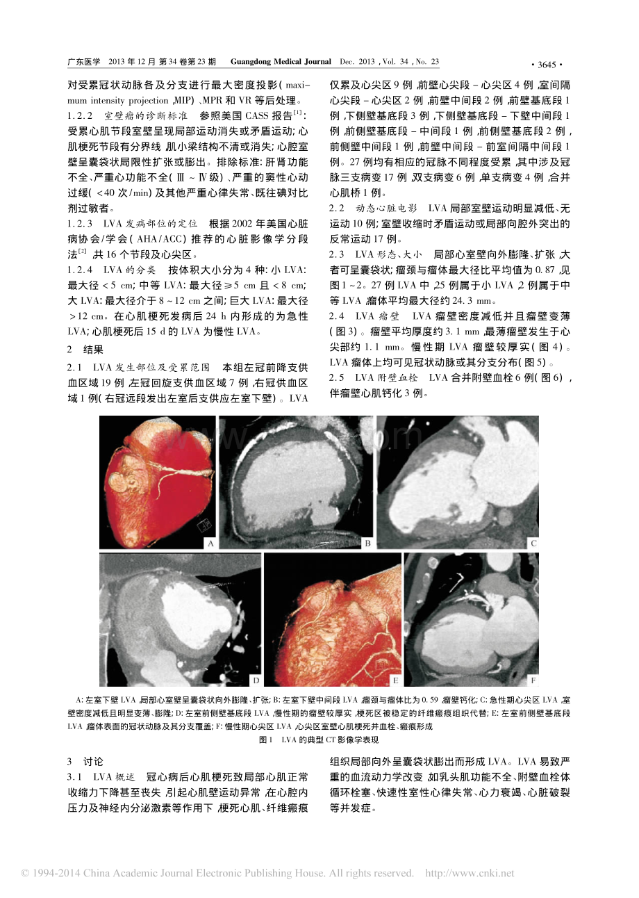 冠心病室壁瘤的CT影像学表现.pdf_第2页