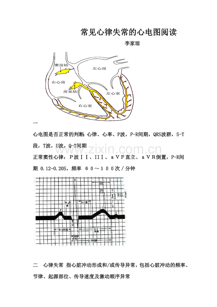 常见心律失常的心电图阅读.doc_第1页