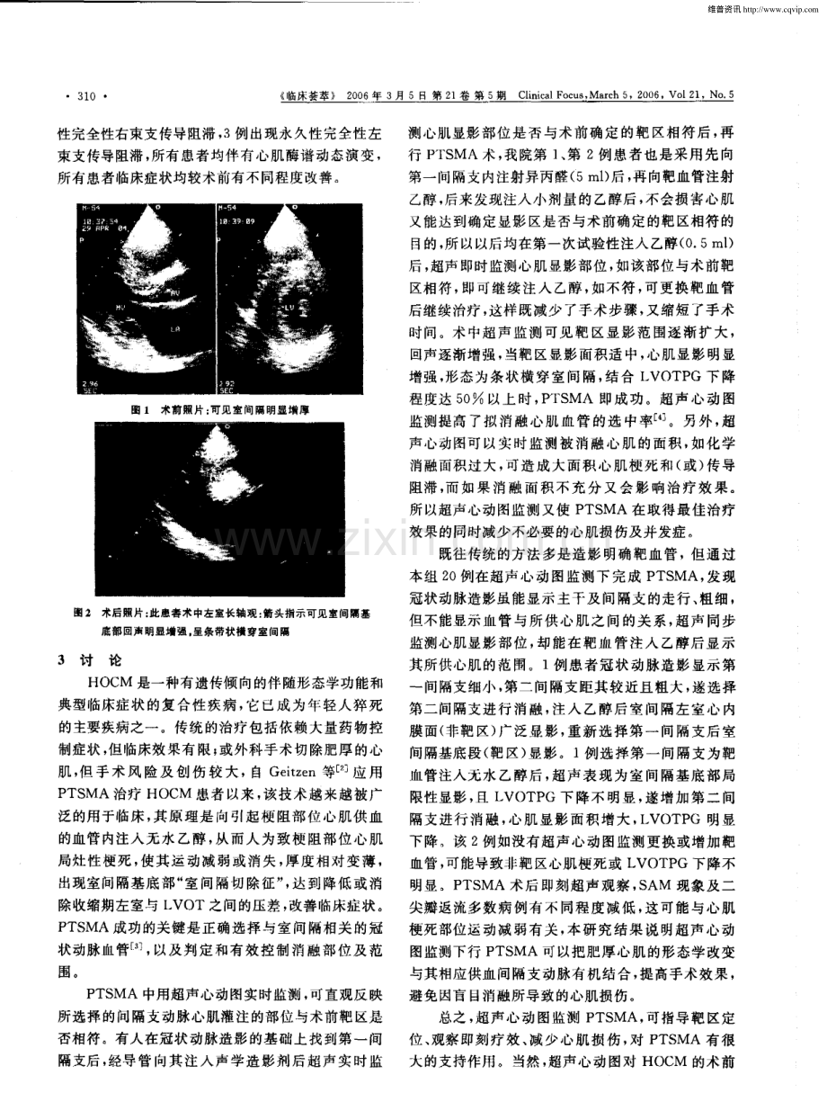 超声心动图在肥厚型梗阻性心肌病经皮间隔化学消融术中的应用.pdf_第3页