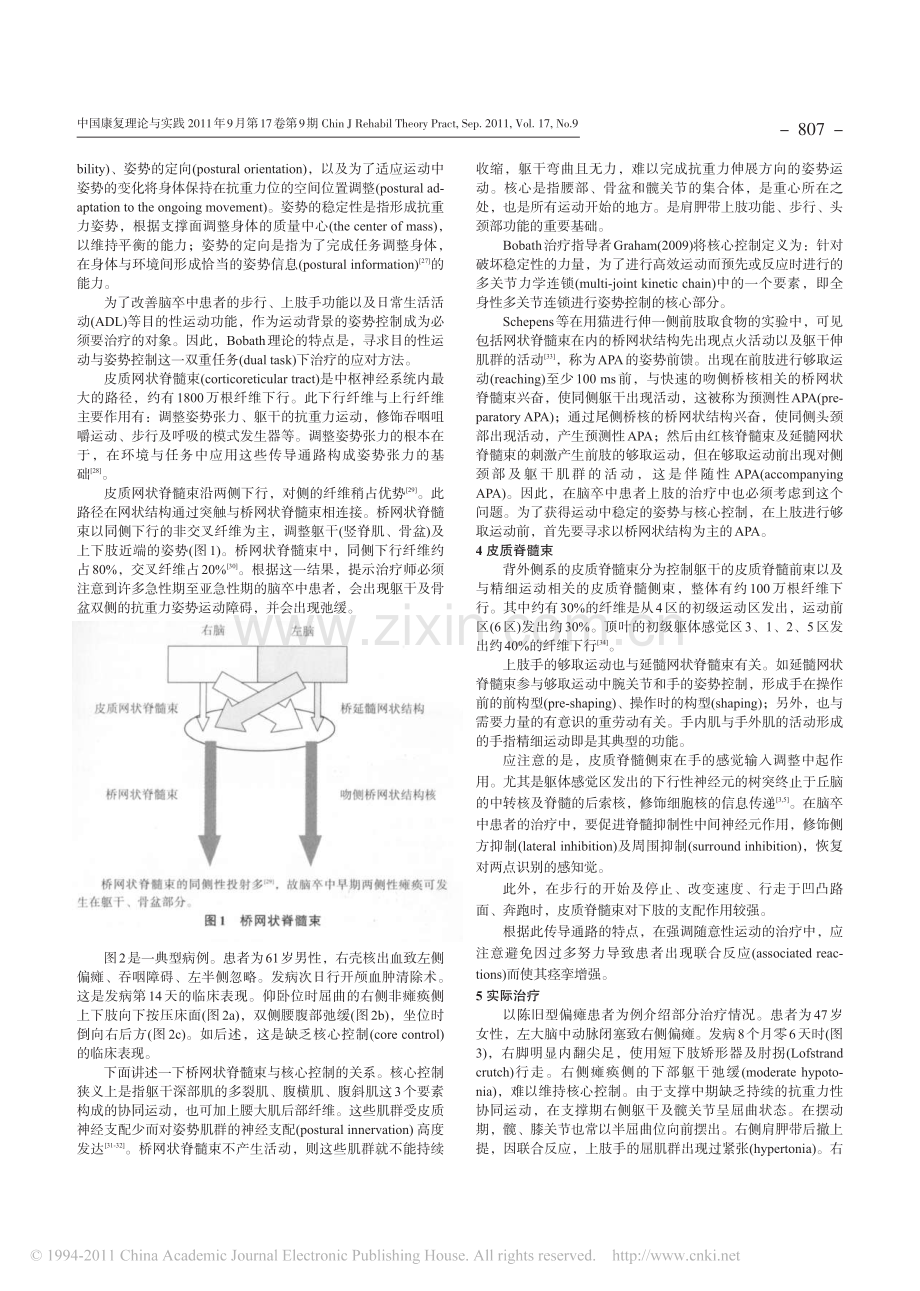 针对脑卒中患者的Bobath治疗方法.pdf_第3页