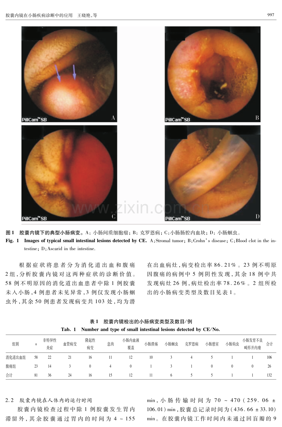 胶囊内镜在小肠疾病诊断中的应用.pdf_第3页