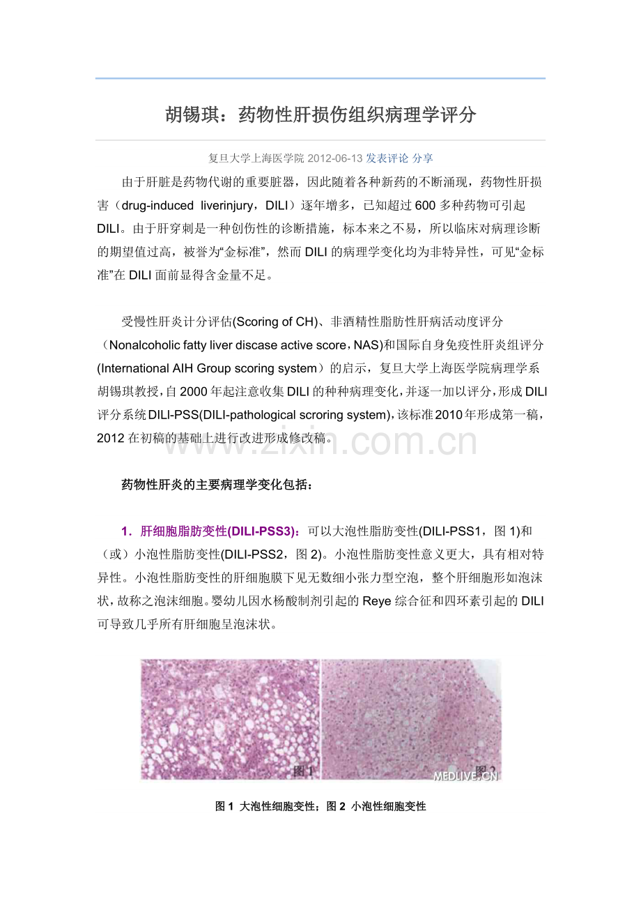 药物性肝损伤组织病理学评分.docx_第1页