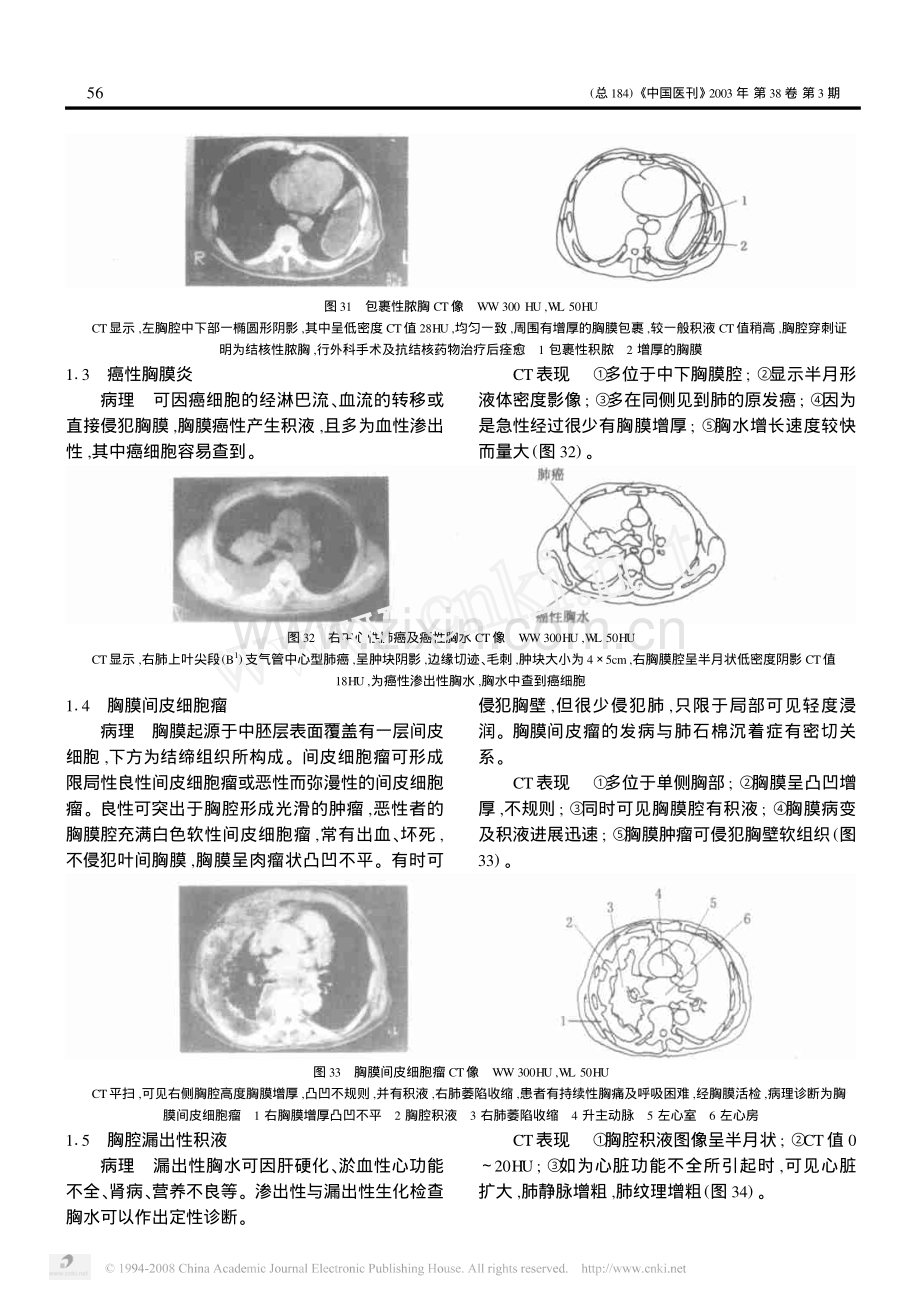 第12讲胸部疾病的CT诊断_三_胸膜_纵隔_心脏血管及胸壁疾病.pdf_第2页