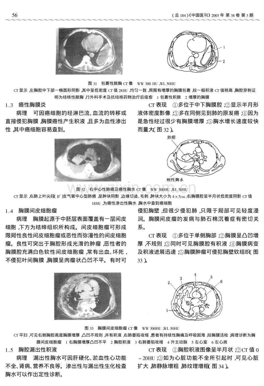 断三胸膜、纵隔、心脏血管及胸壁疾病.pdf_第2页