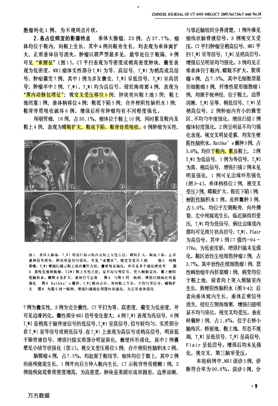 鞍区占位病变的影像诊断.pdf_第2页