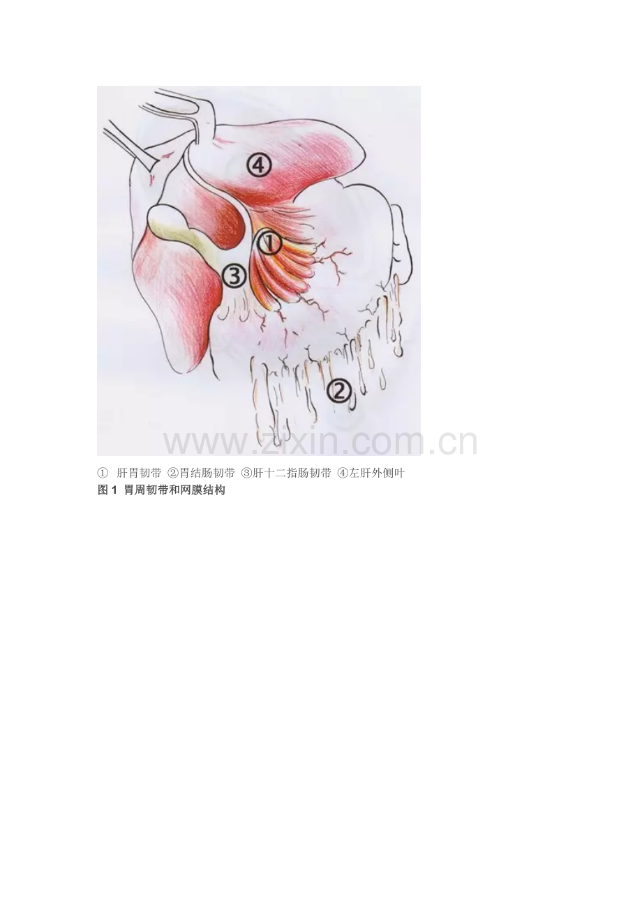 【手术图解】胃癌根治术(一)：胃的毗邻和腹膜.doc_第2页