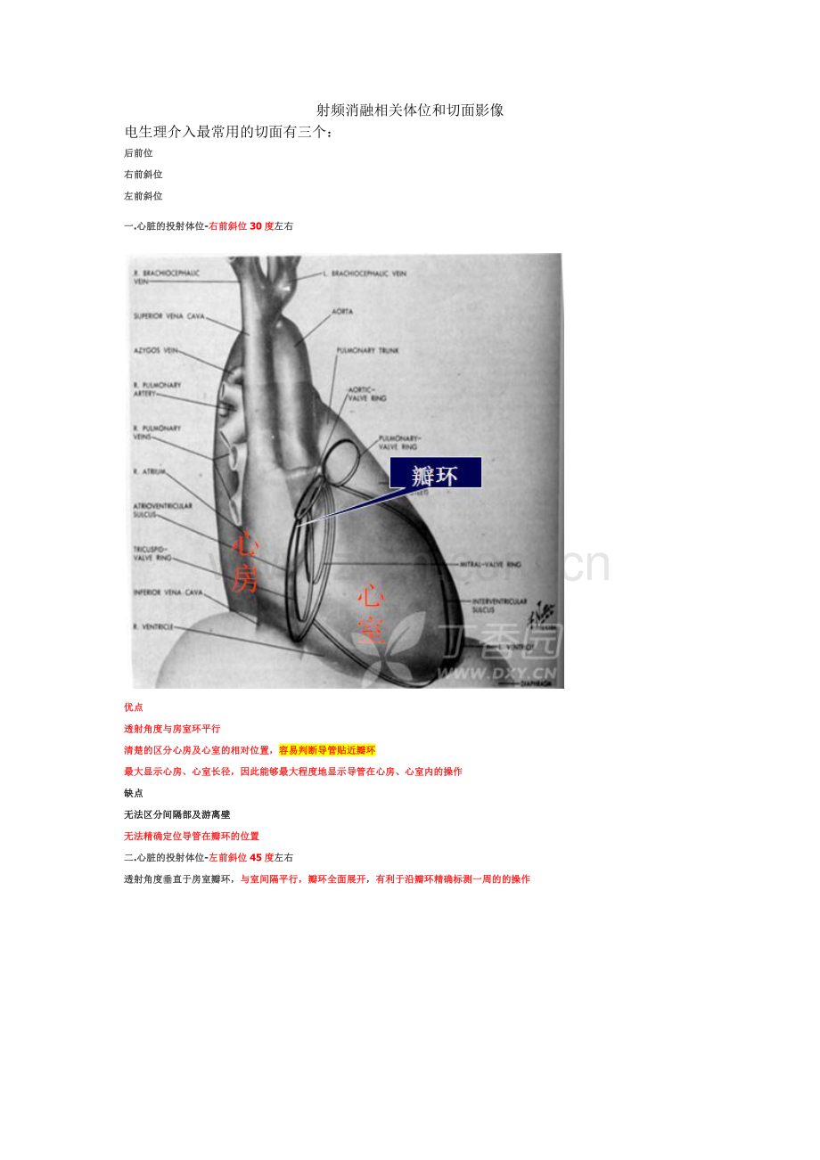 心脏电生理介入扫盲贴.docx_第1页