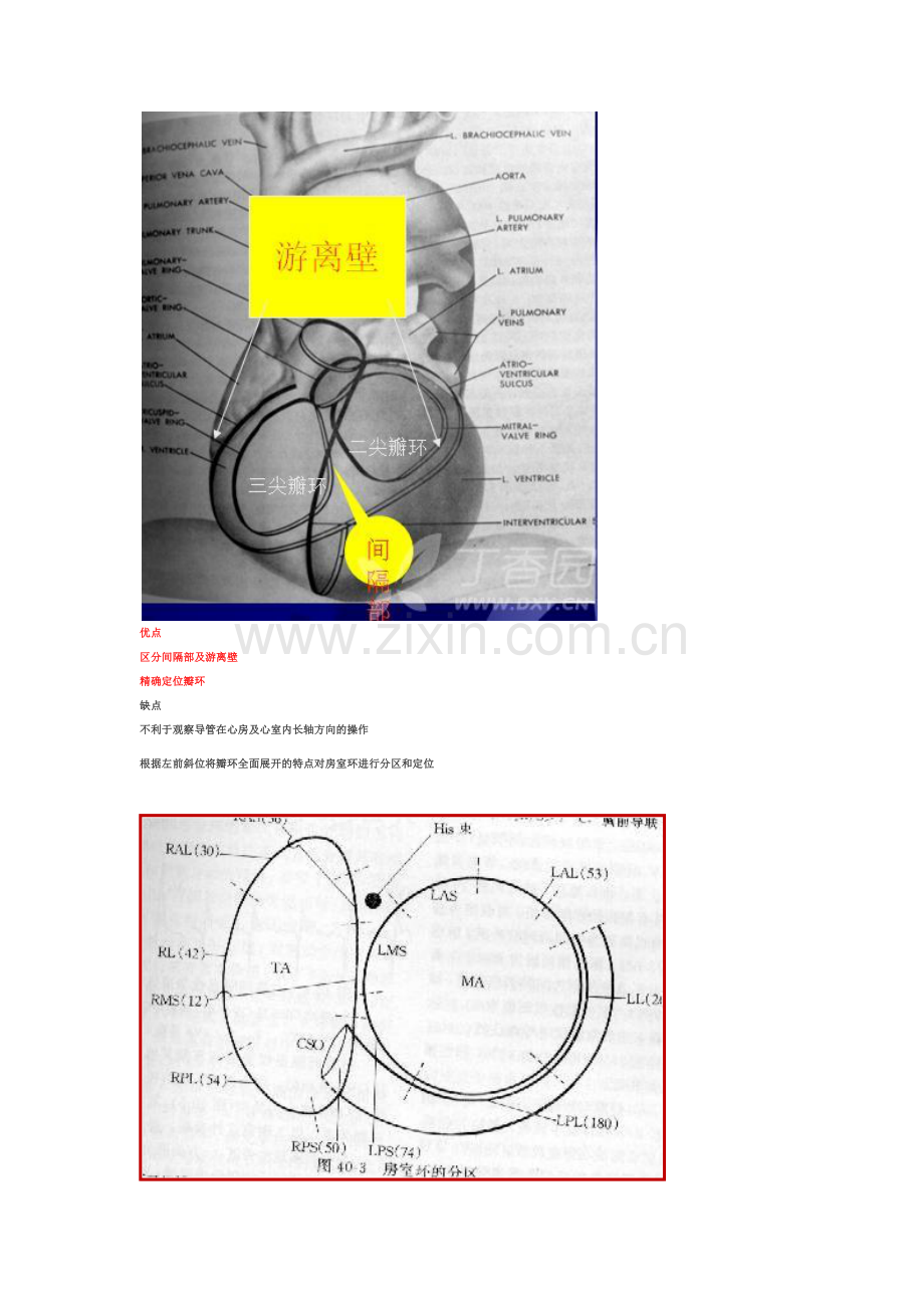 心脏电生理介入扫盲贴.docx_第2页