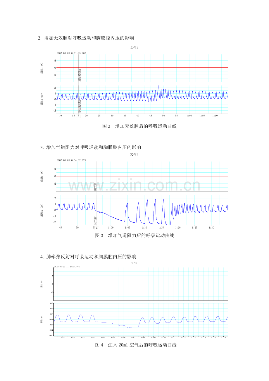 家兔呼吸运动和胸内负压的影响因素观测.doc_第3页