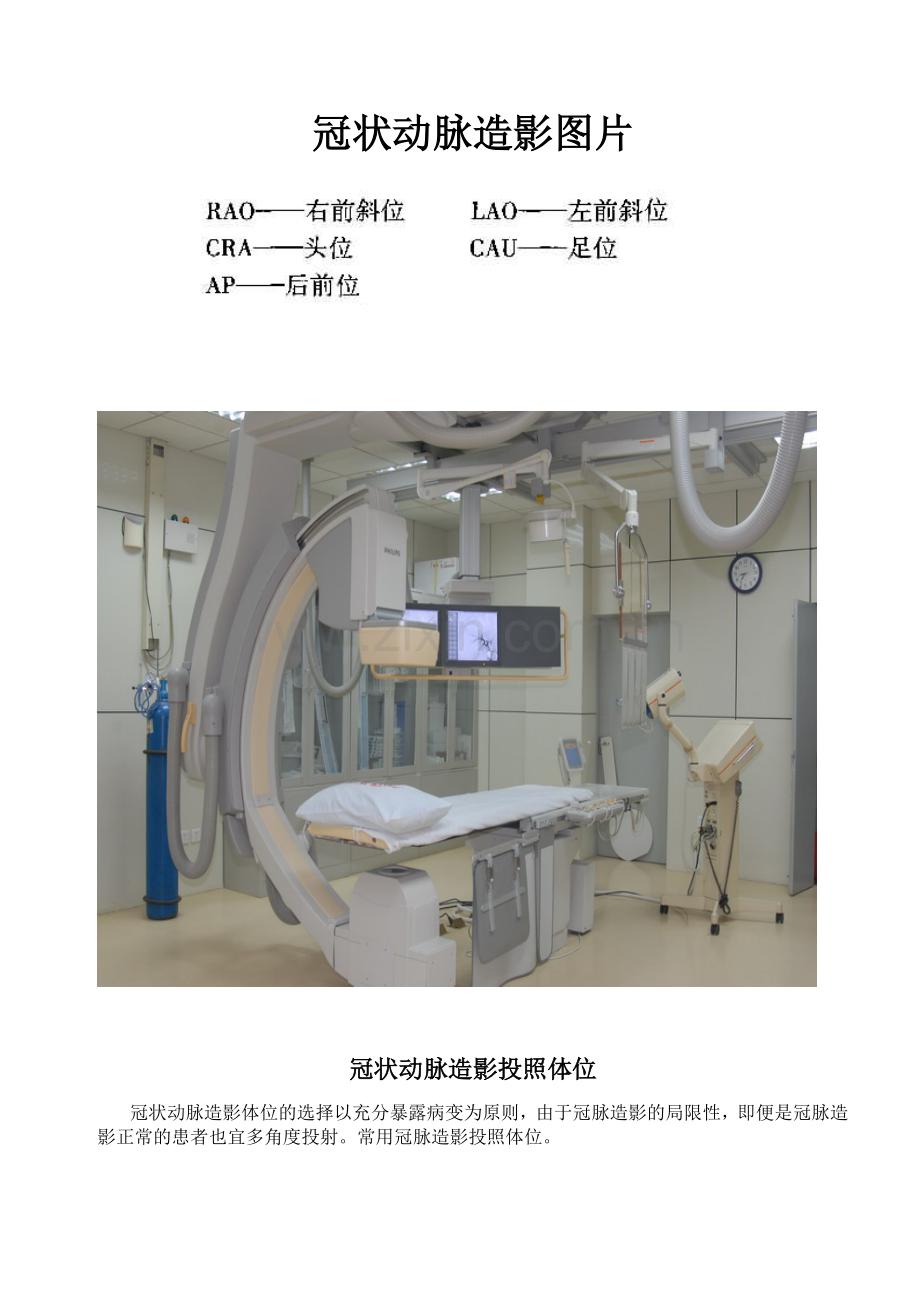 冠状动脉造影体位图片.doc_第1页