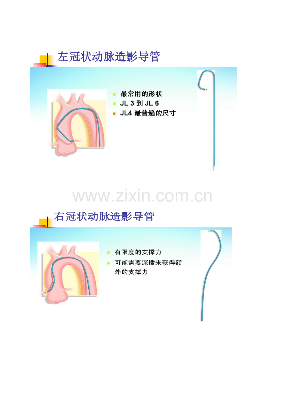 冠状动脉造影体位图片.doc_第3页