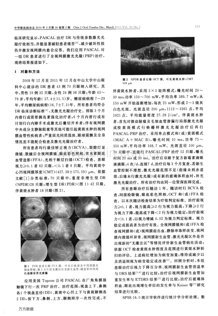 短脉冲模式扫描激光治疗糖尿病视网膜病变疗效观察.pdf_第2页