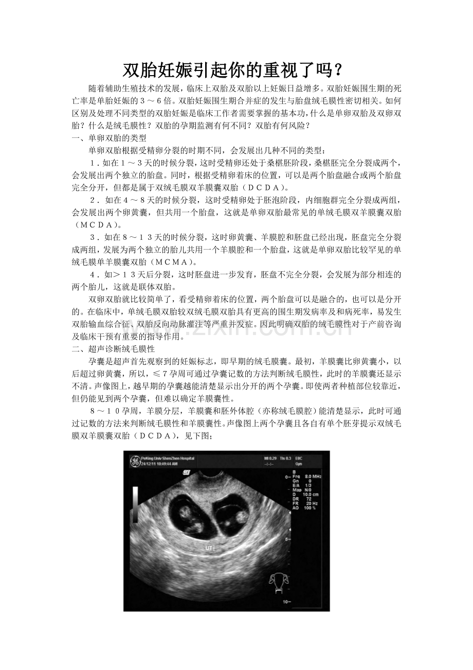 双胎妊娠.doc_第1页