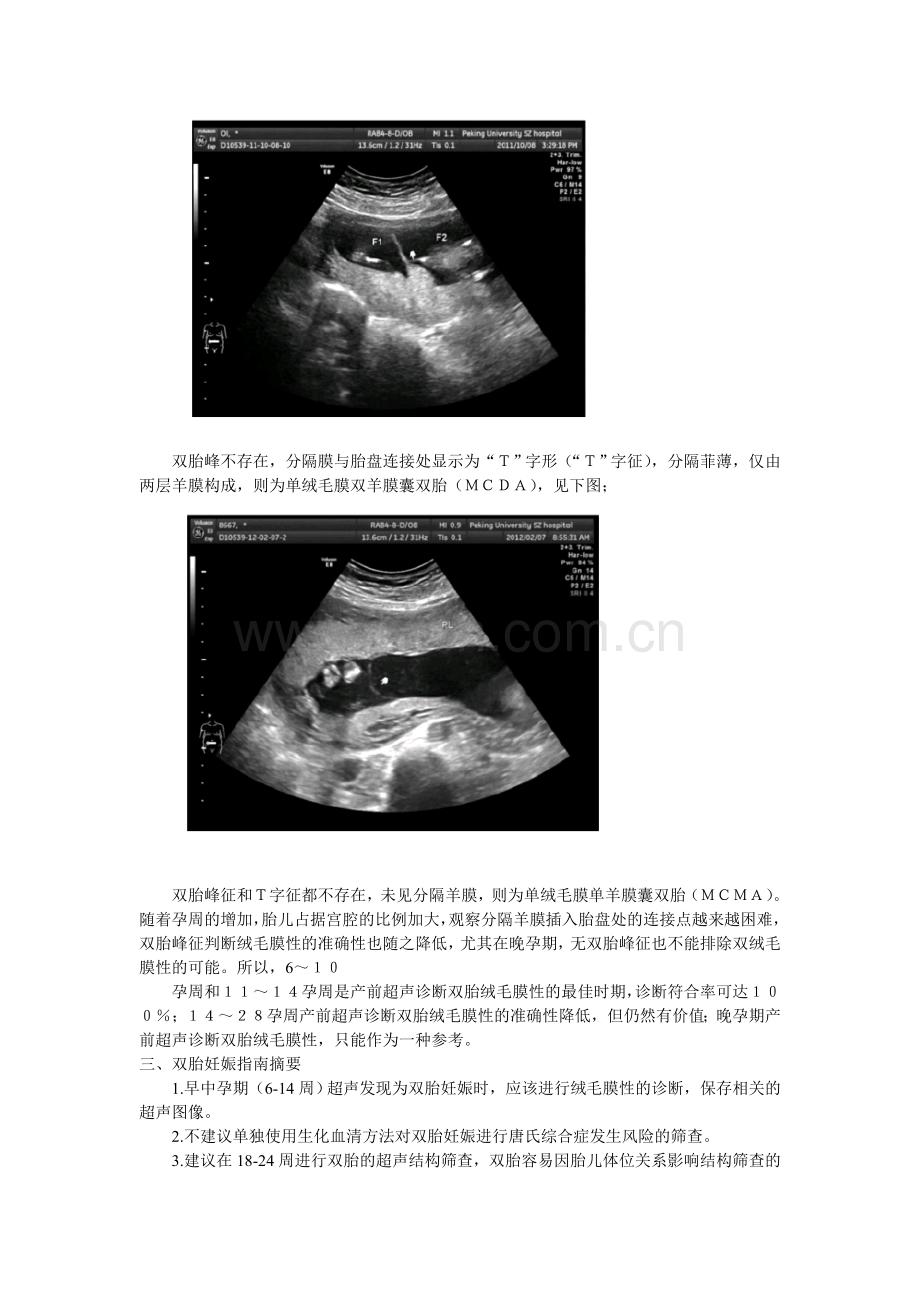 双胎妊娠.doc_第3页