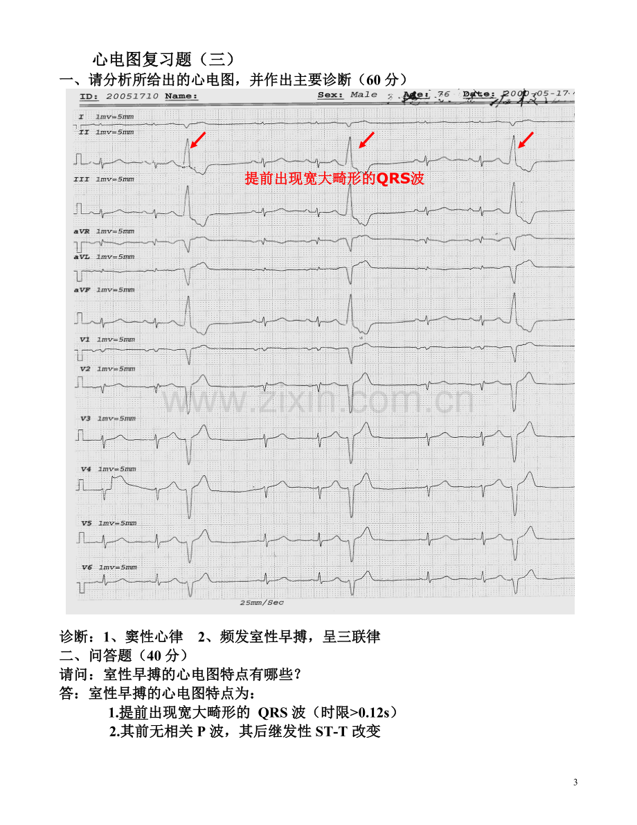 临床“三基”考试心电图复习题(图及答案)-(1).doc_第3页