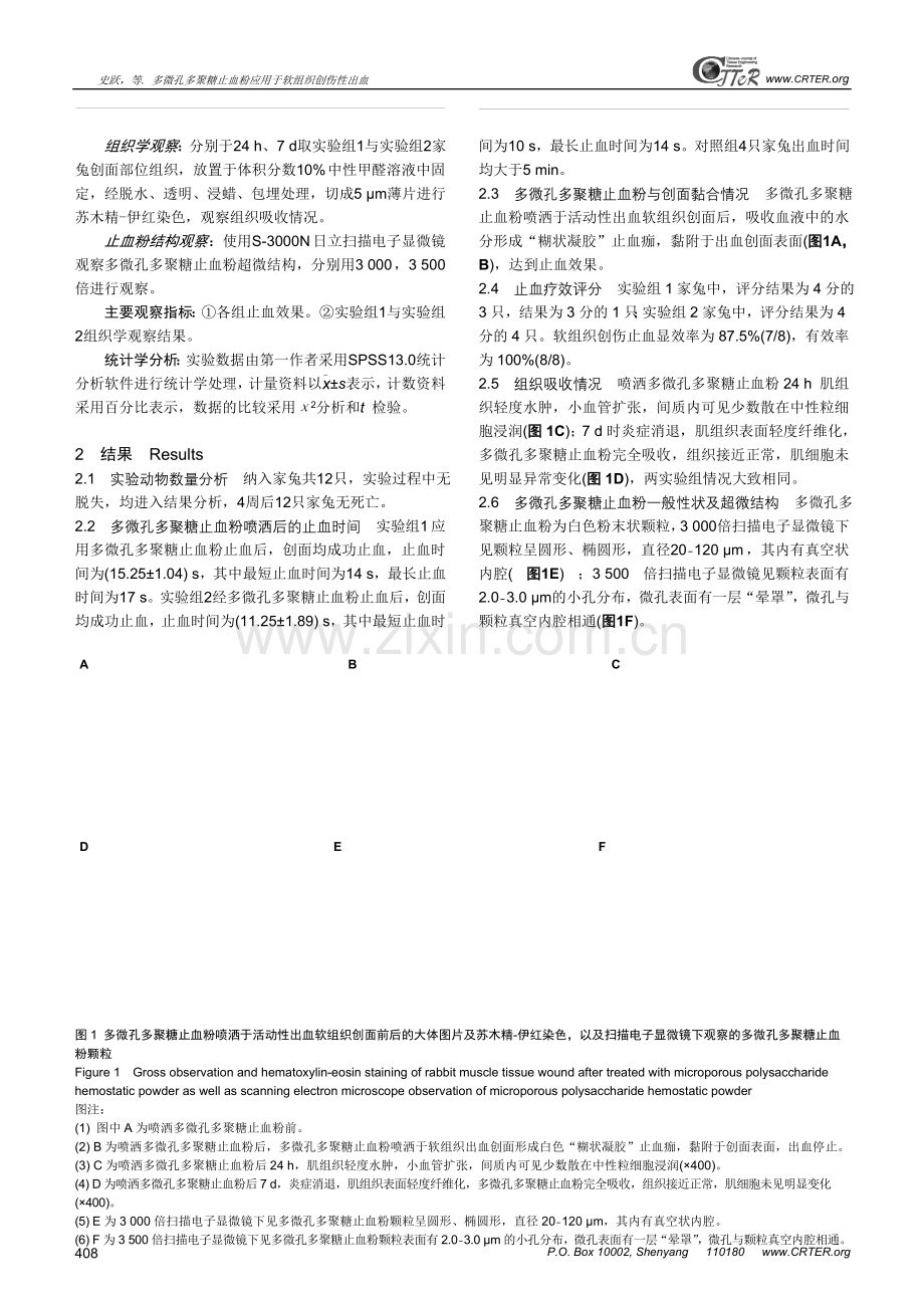 多微孔多聚糖止血粉应用于软组织创伤性出血.doc_第3页