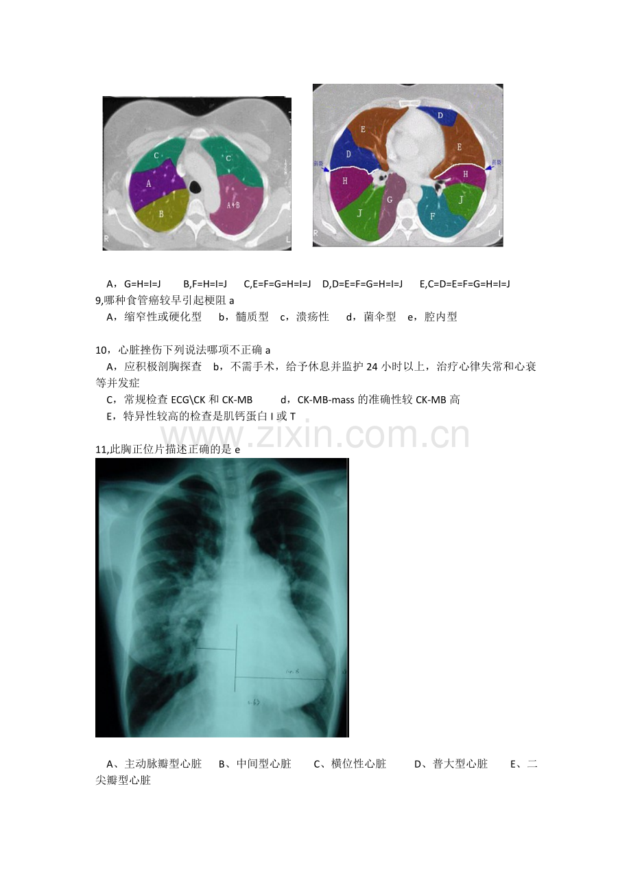 胸外科单选题1.doc_第2页