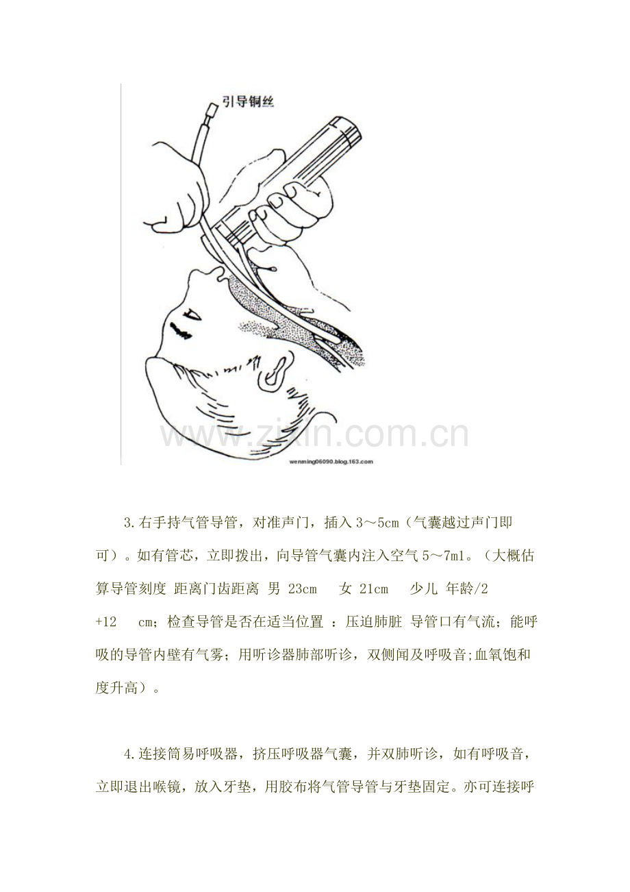 气管插管汇编.doc_第2页