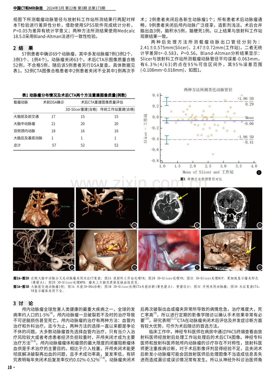 3D-Slicer重建CTA在颅内动脉瘤夹闭术后随访中的应用.pdf_第2页