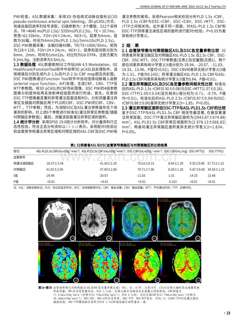 3D-pCASL评估单侧大脑中动脉慢性重度狭窄患者脑血流动力学可行性研究.pdf_第2页