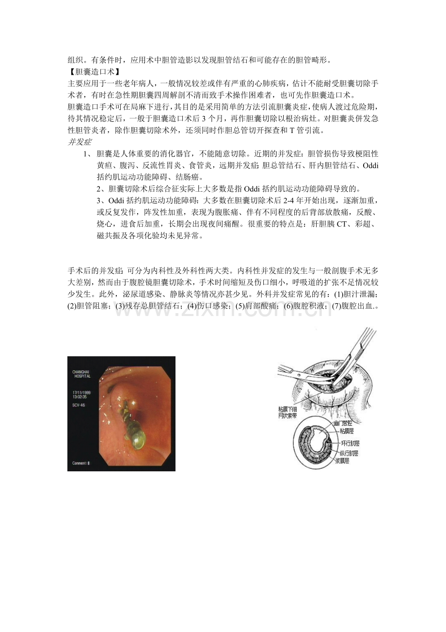 胆结石的治疗原则.doc_第2页