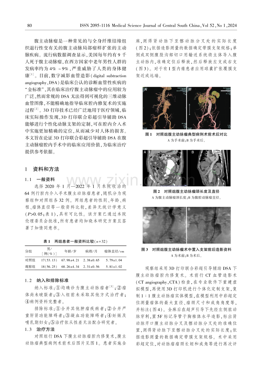 3D打印联合彩超引导辅助DSA在腹主动脉瘤腔内介入手术中的临床应用.pdf_第2页