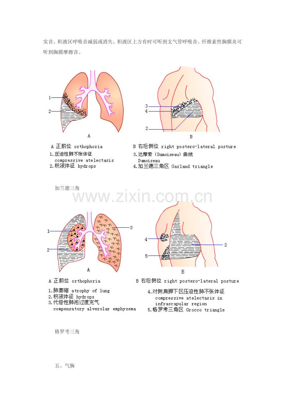 胸部检查(五)-呼吸系统常见疾病主要症状及体征.doc_第3页