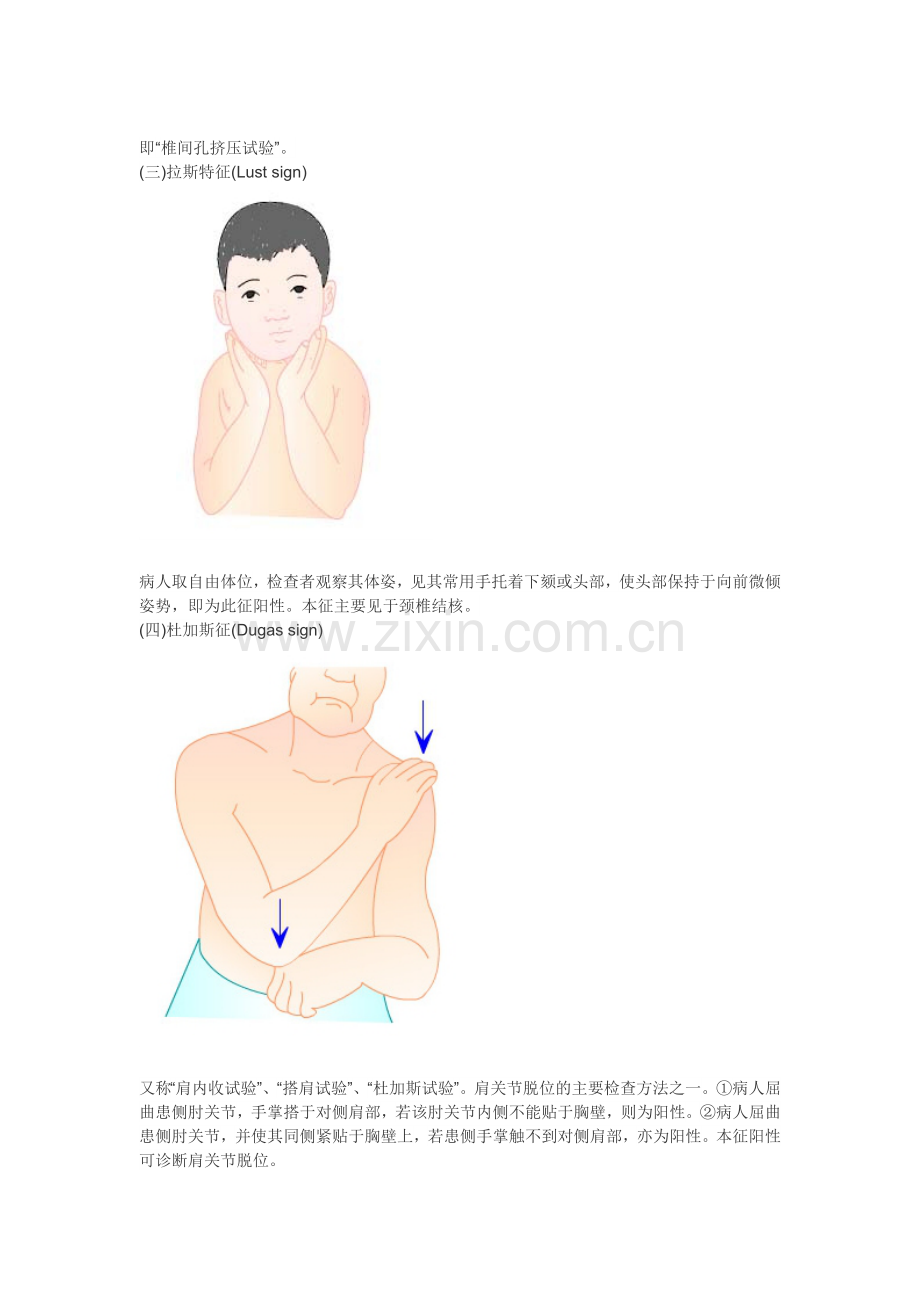 临床常用脊柱与四肢特殊检查.doc_第2页