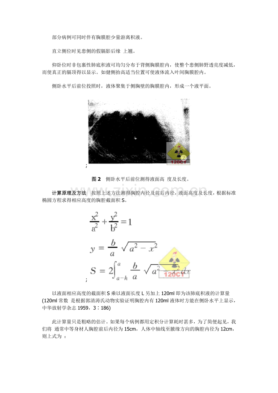 肺底积液的X线诊断及积液量的计算.doc_第2页