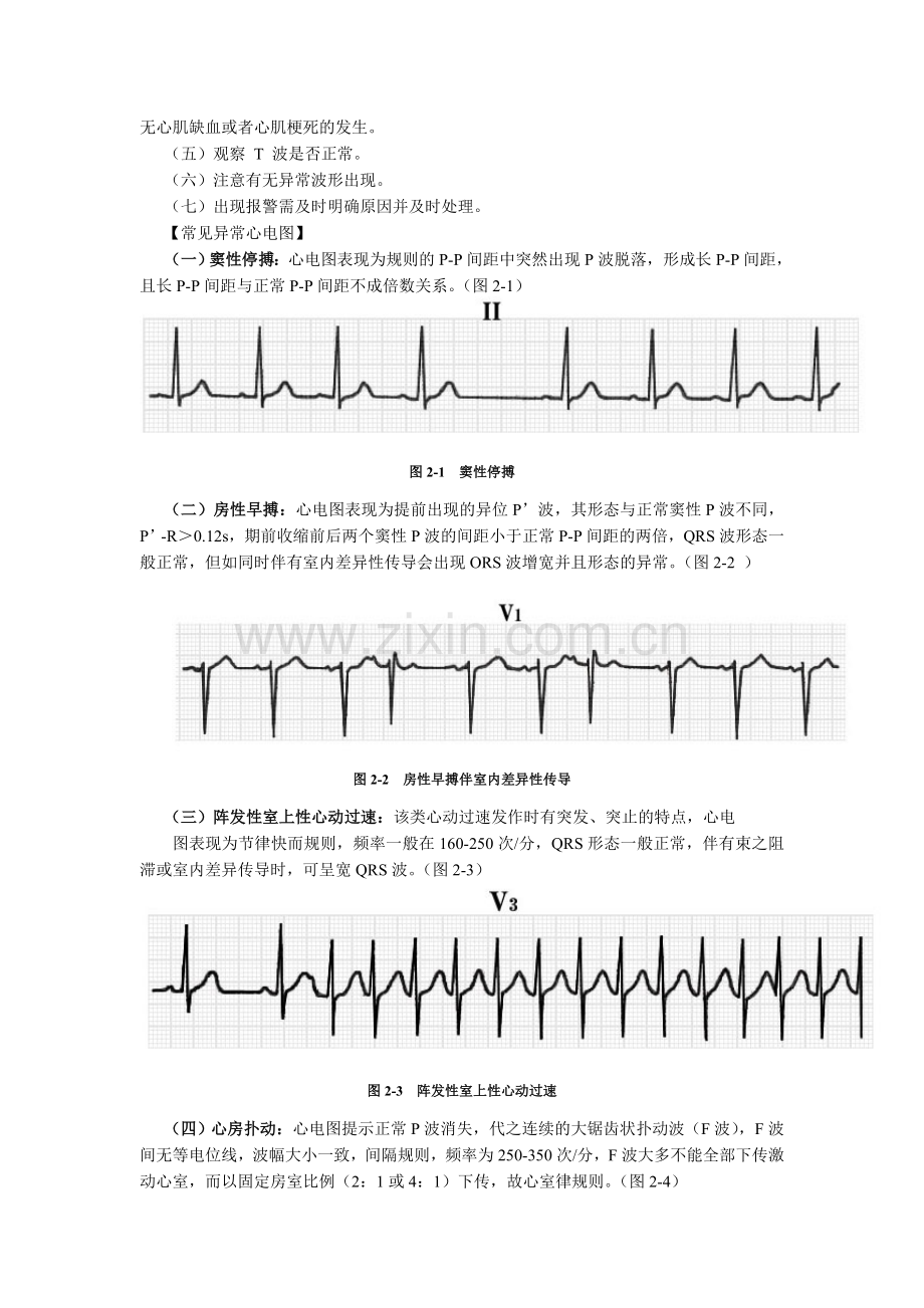 床边生命体征监测(DOC).doc_第2页