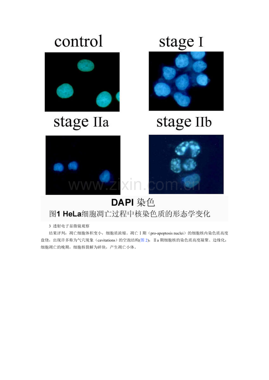 细胞凋亡的检测(含图片) 陈英玉.doc_第2页