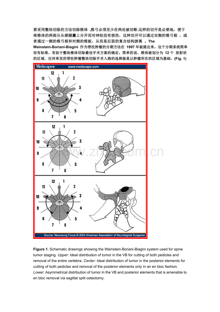 胸腰段椎体肿瘤全椎体切除的原理和技术.doc_第2页