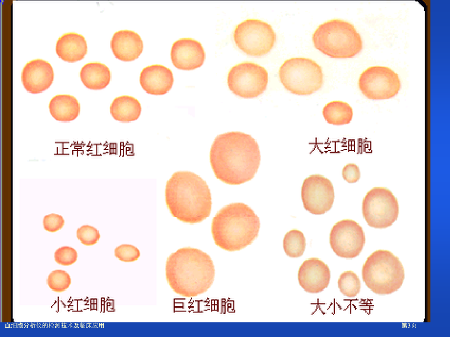 血细胞分析仪的检测技术及临床应用.pptx_第3页