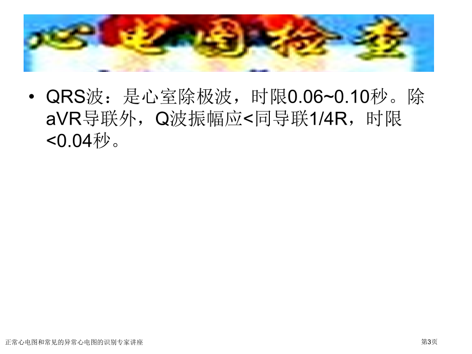 正常心电图和常见的异常心电图的识别专家讲座.pptx_第3页