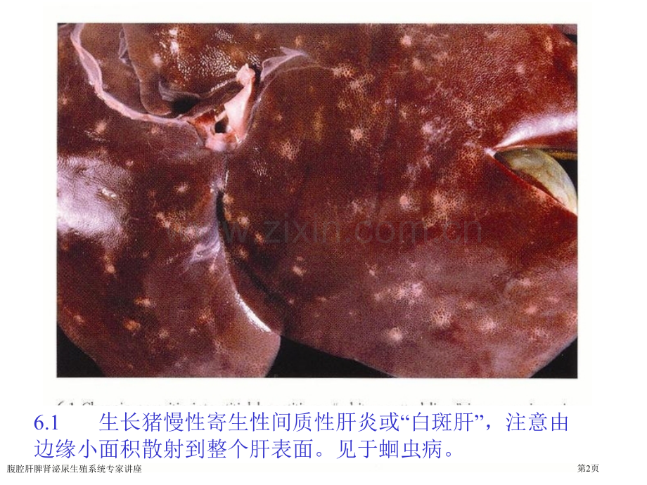 腹腔肝脾肾泌尿生殖系统专家讲座.pptx_第2页