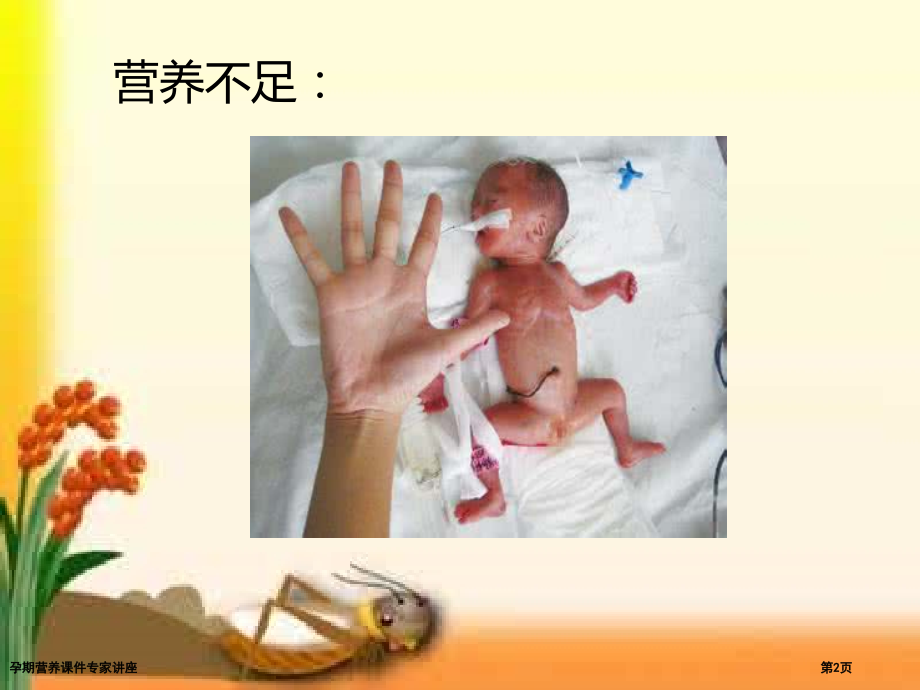 孕期营养课件专家讲座.pptx_第2页