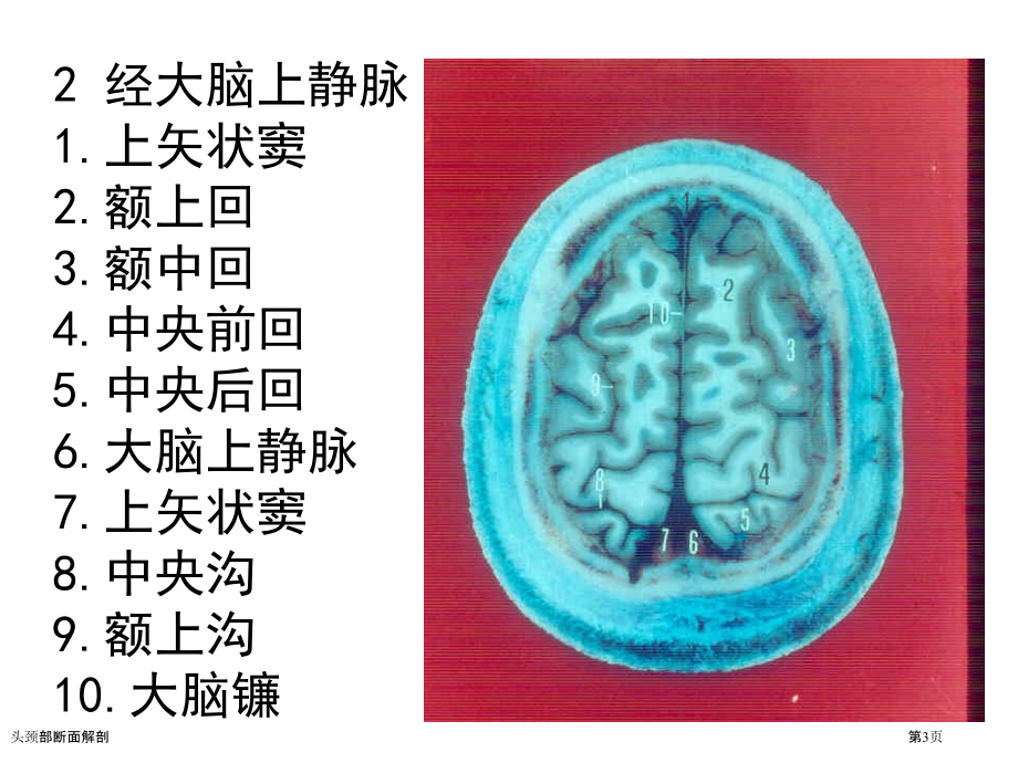 头颈部断面解剖.pptx_第3页