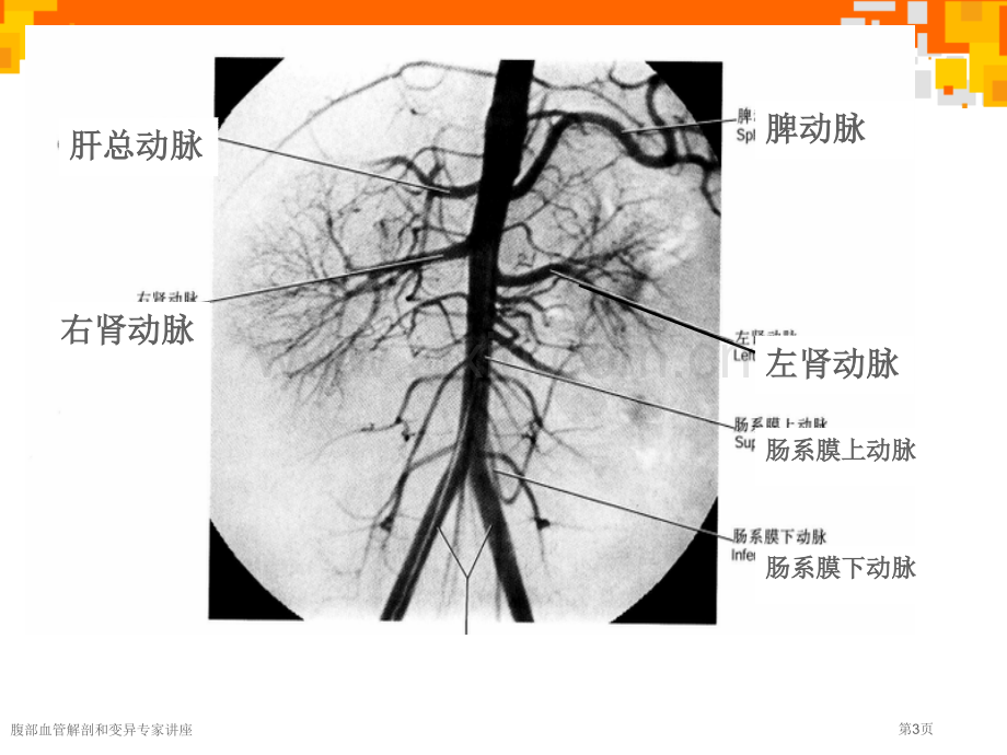 腹部血管解剖和变异专家讲座.pptx_第3页