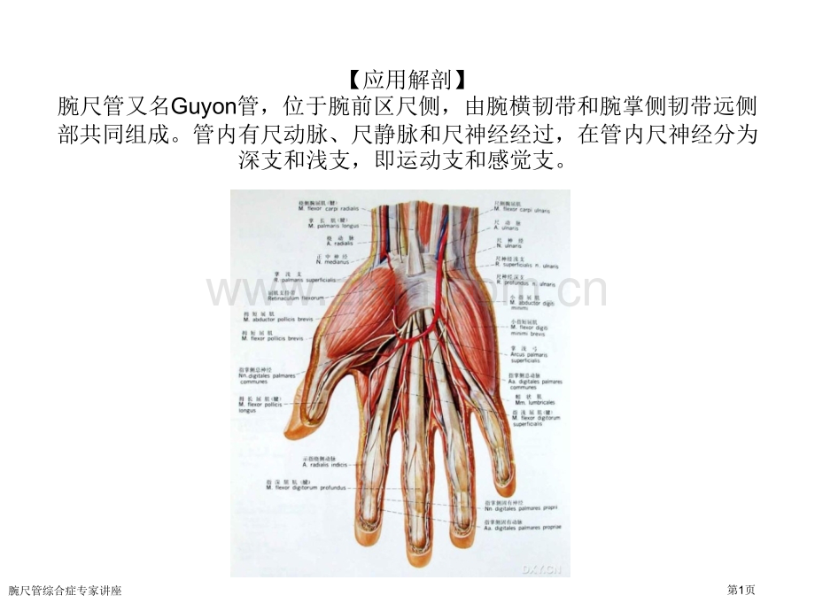 腕尺管综合症专家讲座.pptx_第1页