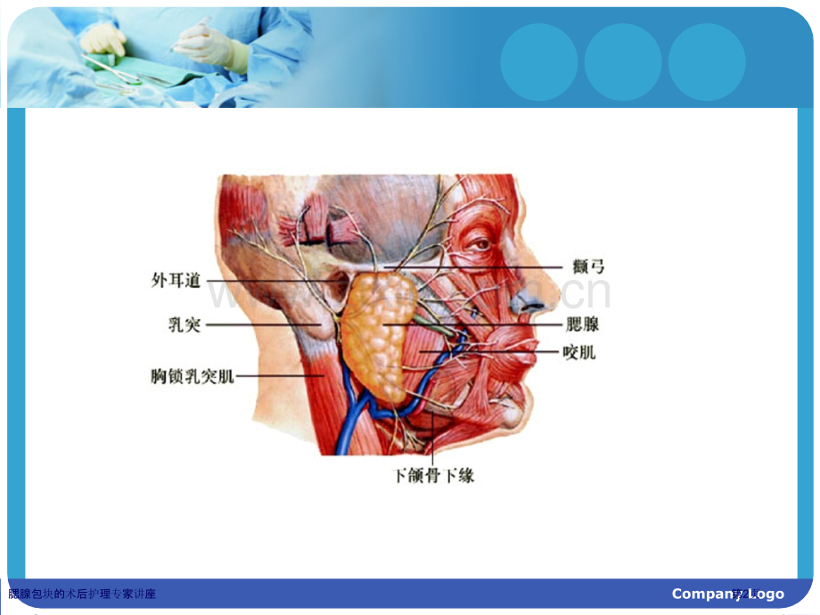 腮腺包块的术后护理专家讲座.pptx_第2页