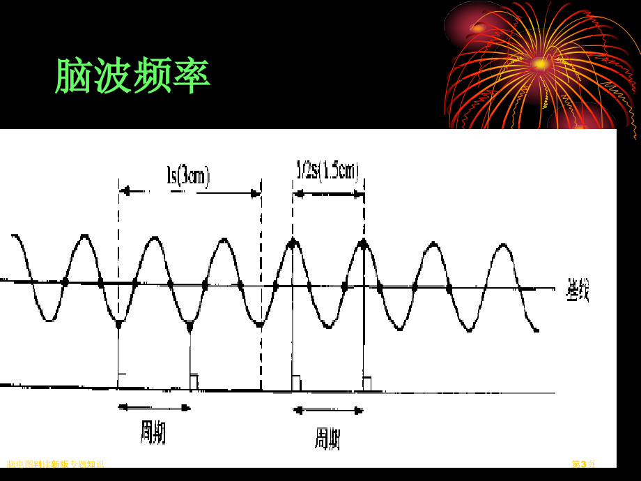 脑电图判读新版专题知识.pptx_第3页