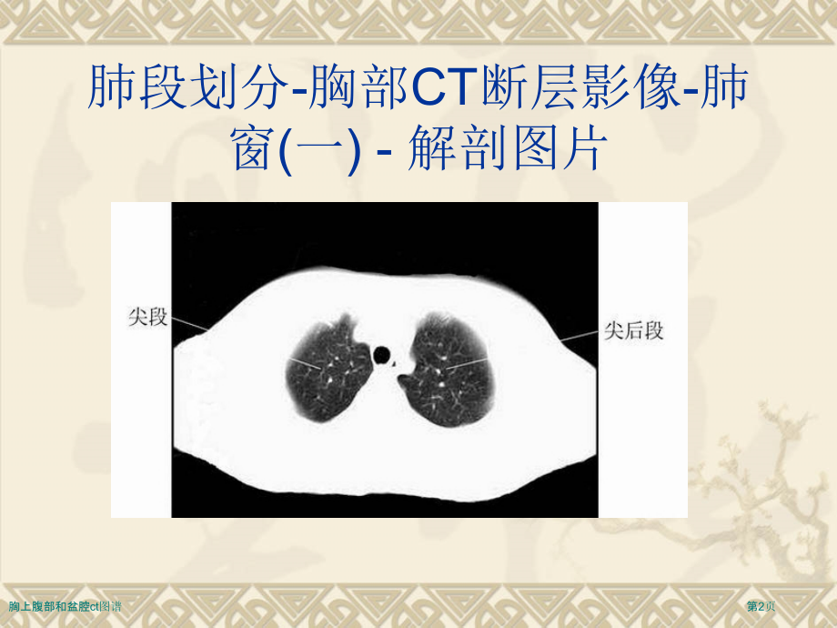 胸上腹部和盆腔ct图谱.pptx_第2页