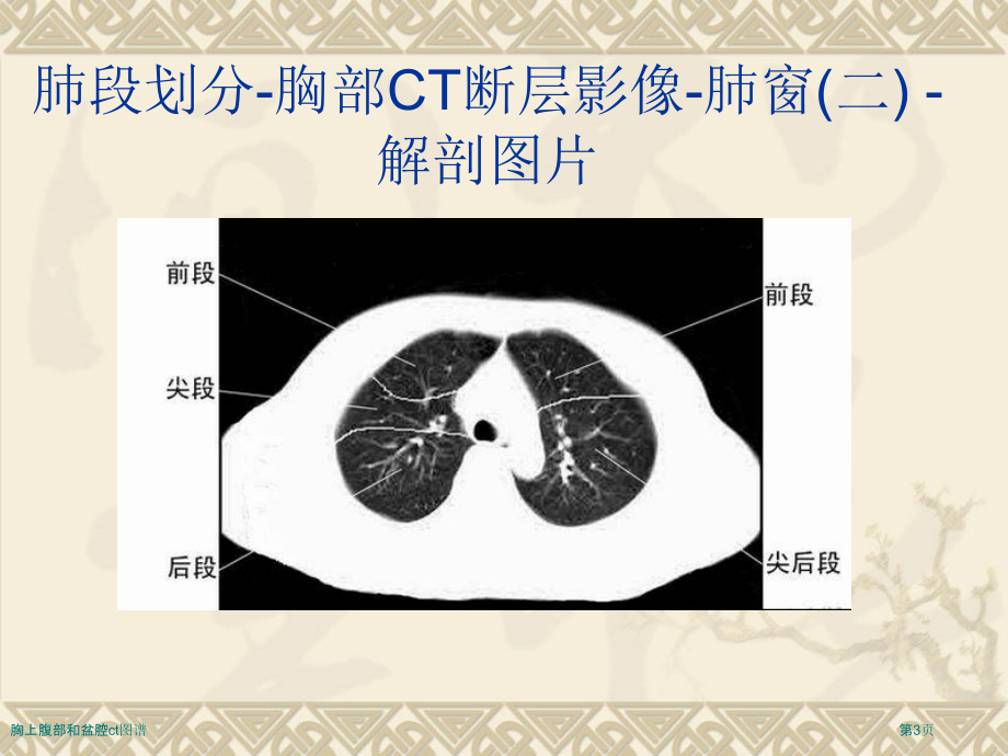 胸上腹部和盆腔ct图谱.pptx_第3页