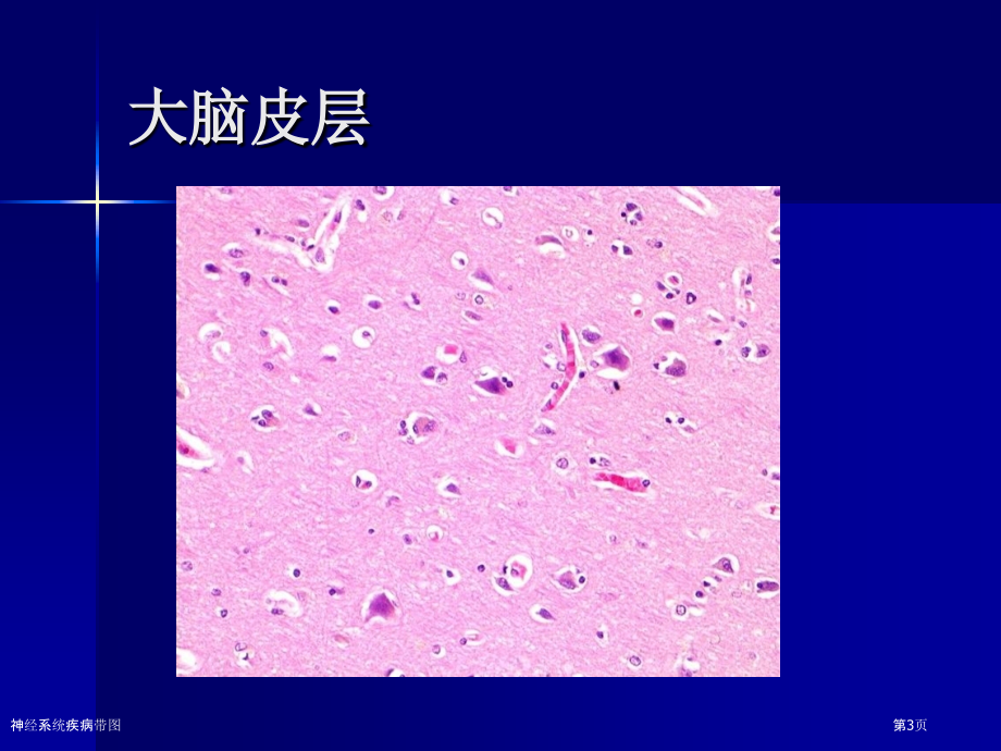 神经系统疾病带图.pptx_第3页