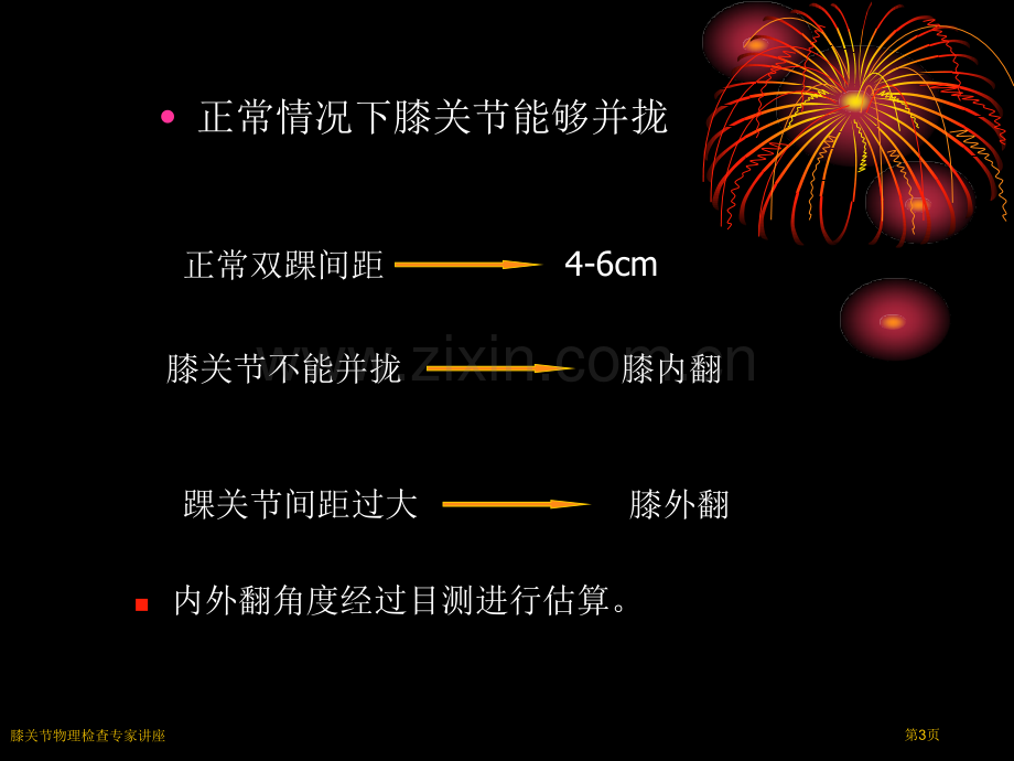 膝关节物理检查专家讲座.pptx_第3页