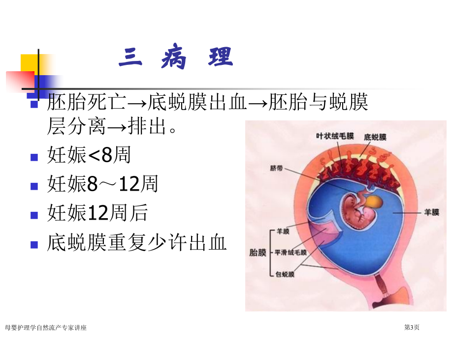 母婴护理学自然流产专家讲座.pptx_第3页