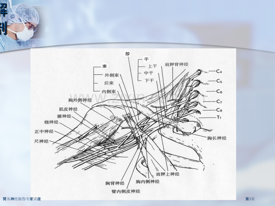 臂丛神经损伤专家讲座.pptx_第3页