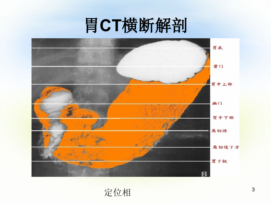 正常腹部CT解剖PPT学习课件.ppt_第3页