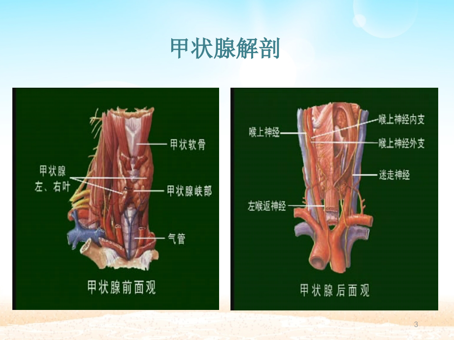 甲状腺次全切除术手术配合课件.ppt_第3页