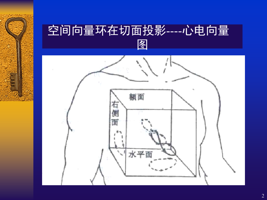 常见心电图诊断要点PPT参考课件.ppt_第2页